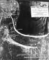 Click For Enlargement